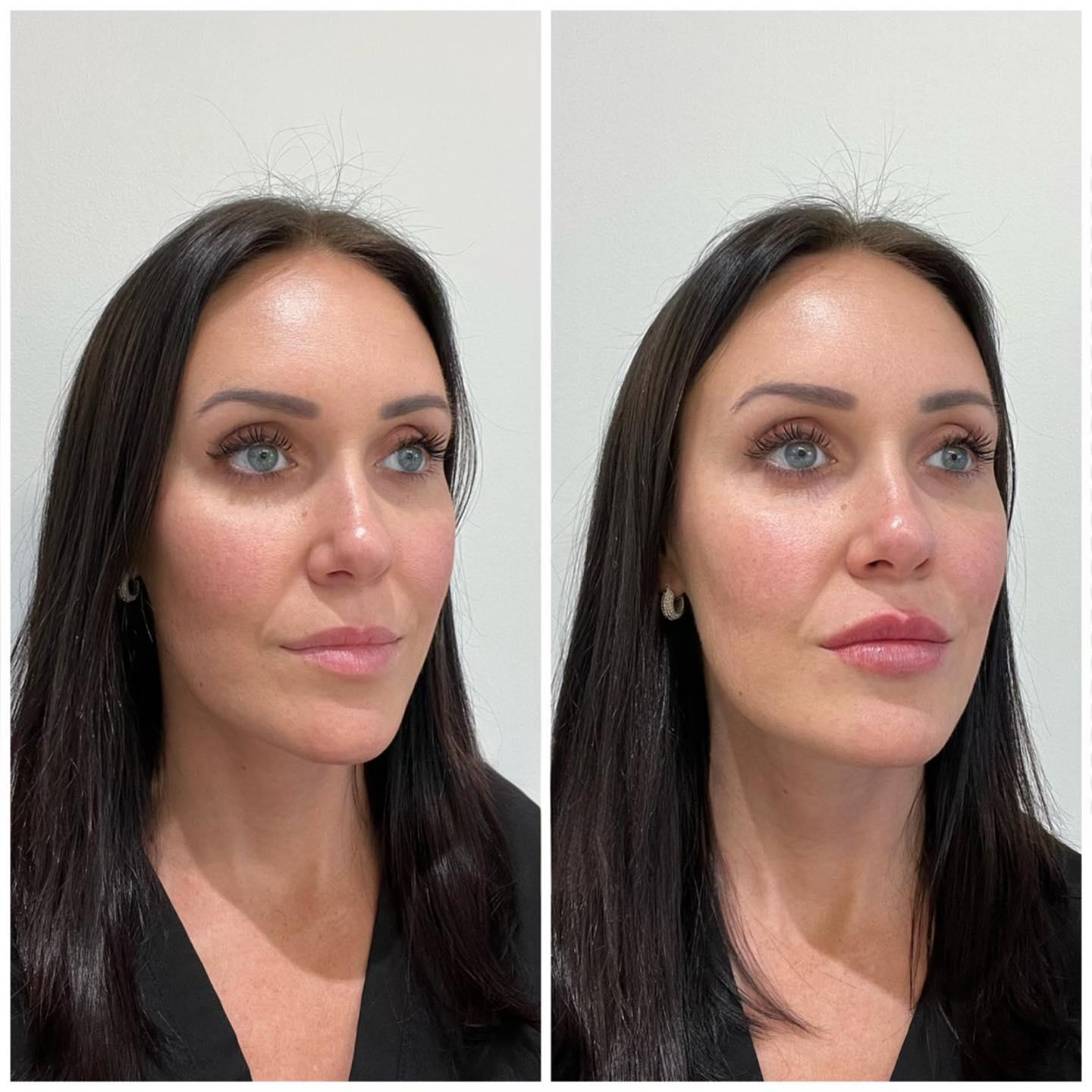 Reedleshot Lip Plumper